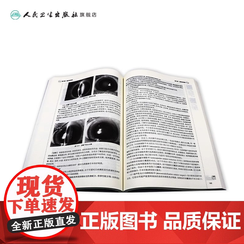 眼科学基础(第2版) 贾松、崔云主编 高职高专眼视光专业 9787117219495人民卫生出版社2019年11月规划教高清大图