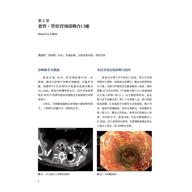 醉染图书消化道术后并发症实例分析9787571412135高清大图