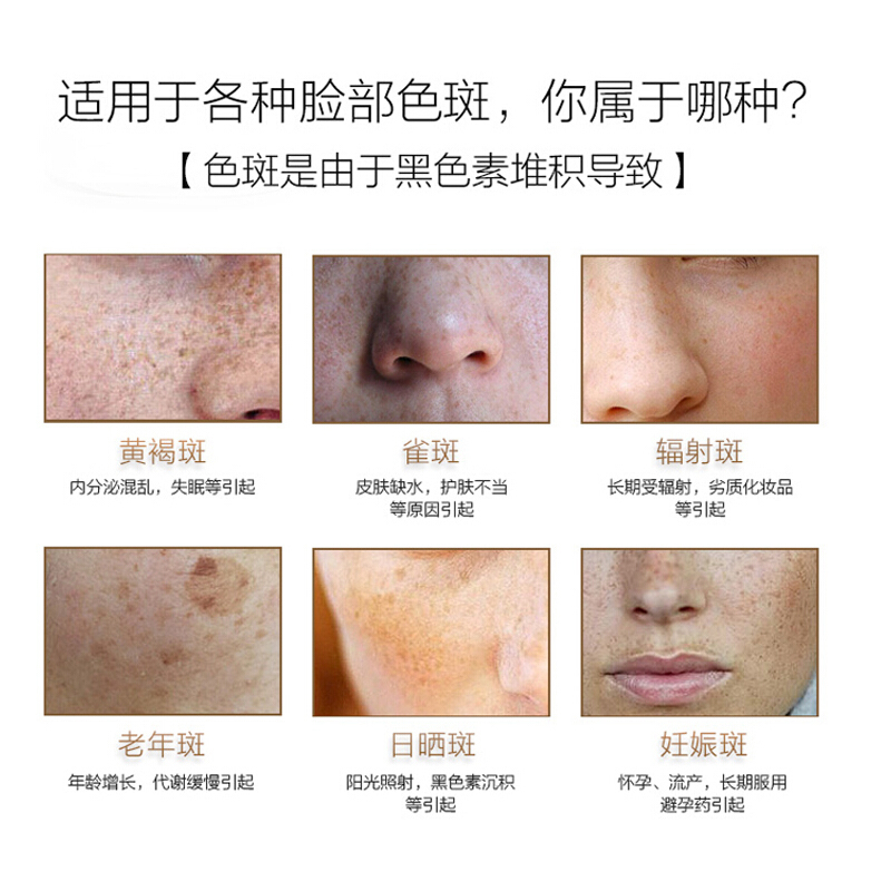 同仁堂(TRT)护肤品祛斑润肤霜 45g 祛斑霜日霜 男女士祛斑产品淡斑淡化雀斑晒斑色斑老年斑保湿面霜精华霜去斑霜