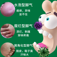 CVKK脚气膏30g*3盒 脚气止痒膏真菌感染脱皮烂脚丫脚臭脚痒水泡型脚烂狼毒抑菌杀菌除水泡型足部护理用品