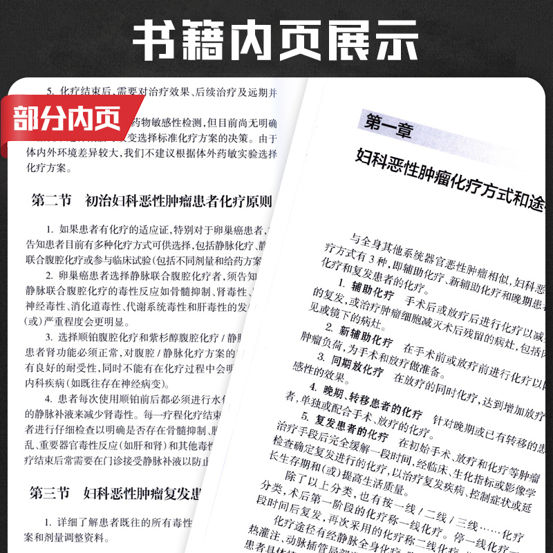 [正版] 妇科恶性肿瘤化疗手册 逸仙妇瘤诊疗规范丛书 李晶 张丙忠主编 妇产科学 肿瘤学 妇科恶性肿瘤诊疗化疗手册 人高清大图