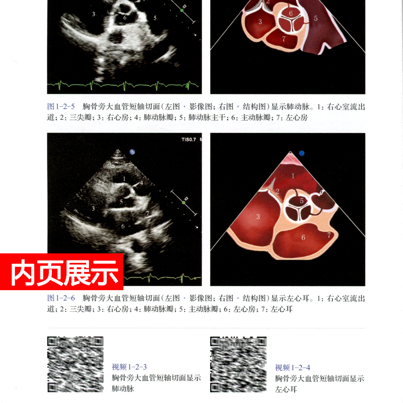 [醉染正版]心脏超声入门 明明白白学超声心脏 超声诊断图谱 心脏超声指南心脏超声诊断学超声心动图胎儿超声医学书籍心电高清大图