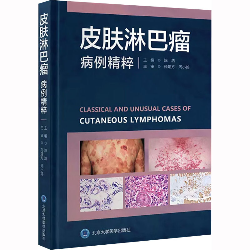 [M]皮肤淋巴瘤病例精粹-9787565927072高清大图