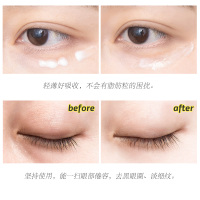 日本明色（MEISHOKU）胎盘素精华抗皱眼霜 30g 1支 淡化去细纹 改善黑眼圈脂肪粒 紧致补水 乳状 日本原装