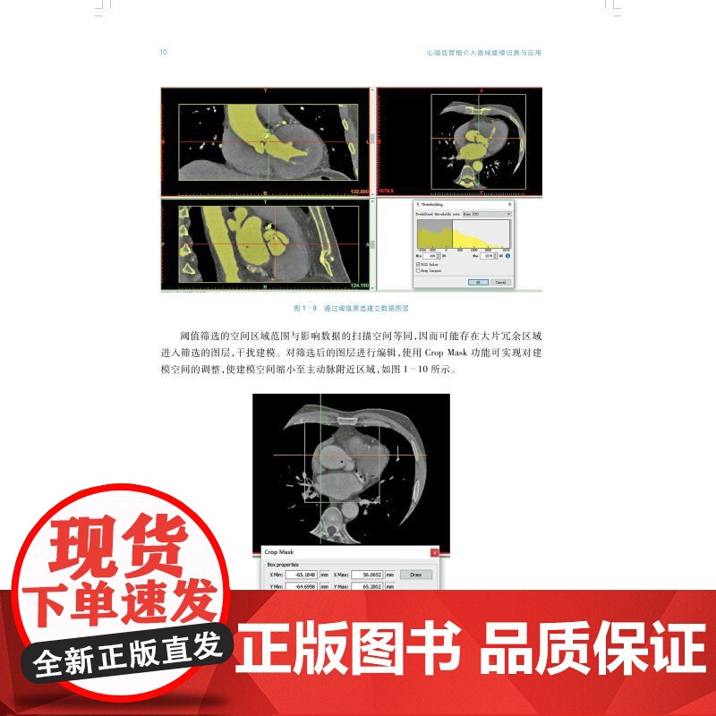 心脑血管植介入器械建模仿真与应用 上海科技出版社计算机建模仿真研究成果高端国产医疗器械发展高清大图