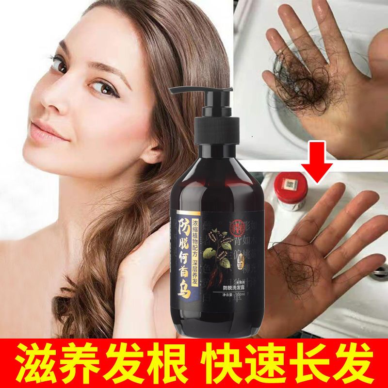 [优先发货][快速长发]防脱发洗发水纯生发增发密发斑秃脂溢性育发液防发 3周期装(严重脱发使用)