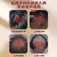 [3瓶装]南京同仁堂生姜洗发水防脱发增发育发固发控油蓬松去屑止痒洗发露