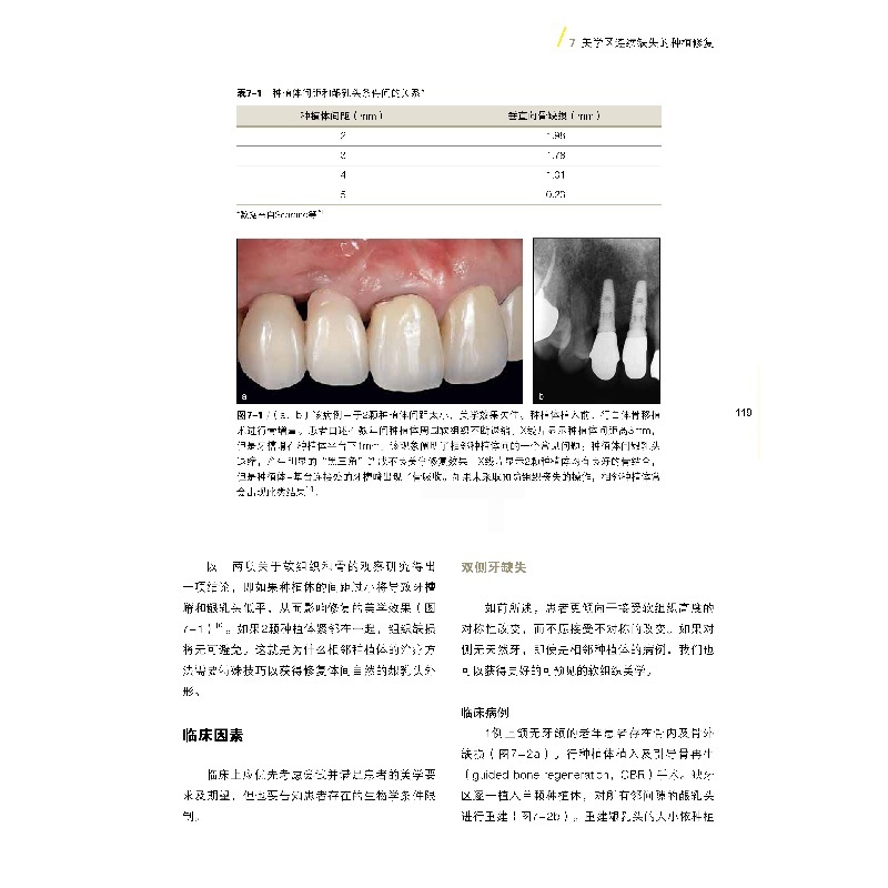 [醉染正版]美学区种植成功之道汤春波主编美学区种植的手术设计美学分析外科操作软硬组织增量二期手术方式辽宁科学技术出版社高清大图
