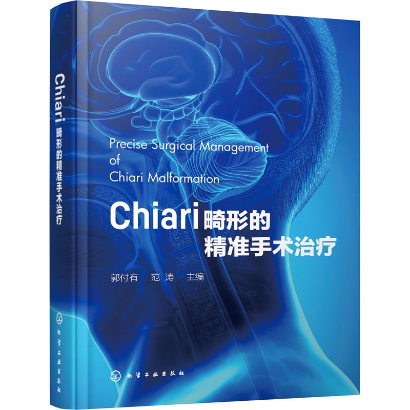 [醉染正版]Chiari畸形的精准手术治疗 郭付有,范涛 编 外科 生活 化学工业书籍类关于有关方面的和与跟学习了解知识高清大图