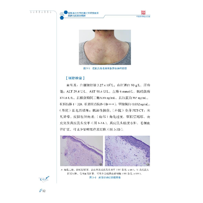 正版 皮肤性病病例精解 高艳青 科学技术文献出版社 978751897643高清大图