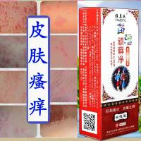 癣王牛皮癣带状疱疹神经痛用药病毒性带状疱疹外用药蛇盘疮缠腰 蛇胆疮蛇癍斑疮后遗症神经刺痛疱肤灵蜘蛛疮 雅美肤癣王喷剂【7