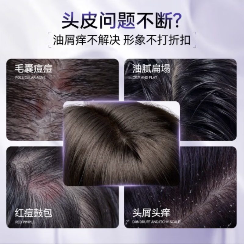 三个魔发匠 二硫化硒控油 去屑洗发水400ml BJDT高清大图