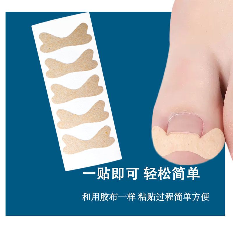 一次性指甲矫正嵌甲贴甲沟纠正贴防止指甲往肉里长脚趾甲纠正贴 1板[5贴]