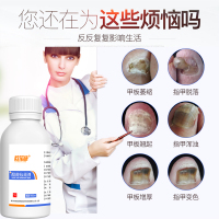 欧诺康 灰指甲专用药水30%冰醋酸溶液稀释泡脚灰趾甲藓皮肤浅部真菌感染涂剂孕妇儿童可用 1瓶 100ml