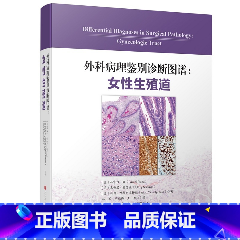 [正版]外科病理鉴别诊断图谱:女性生殖道 杨军 李晓梅 王浩 主译 北京科学技术出版社高清大图