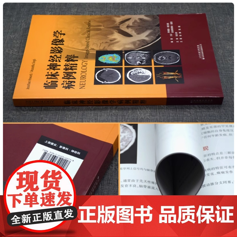 临床神经影像学病例精粹 神经系统疾病影像学 癫痫 脑血管病 自身免疫疾病 脱髓鞘性疾病等 神经病学领域 张静 陈薇主译