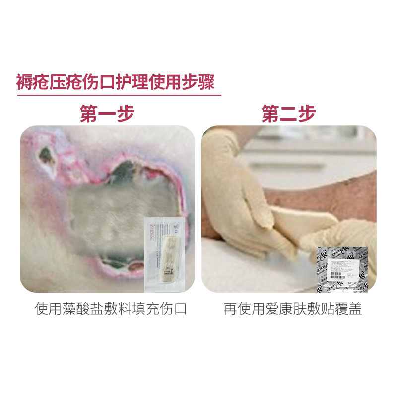 康维德藻酸盐敷料168117片