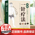 正版 图解一针疗法针虽细物道通神上合于天下合人中医学教程书籍针灸疗法穴位中医临床腧穴定位操作方法书籍中医学针灸入操