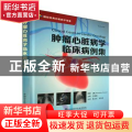肿瘤心脏病学临床病例集