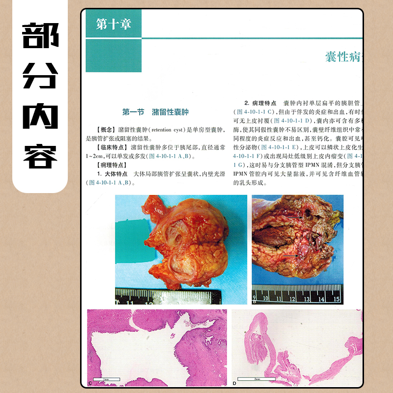 [正版] 临床病理诊断与鉴别诊断肝、胆、胰疾病 丛文铭 郑建明 病理学案例解读教程 肝胆胰疾病参考书 人民卫生出版社9高清大图