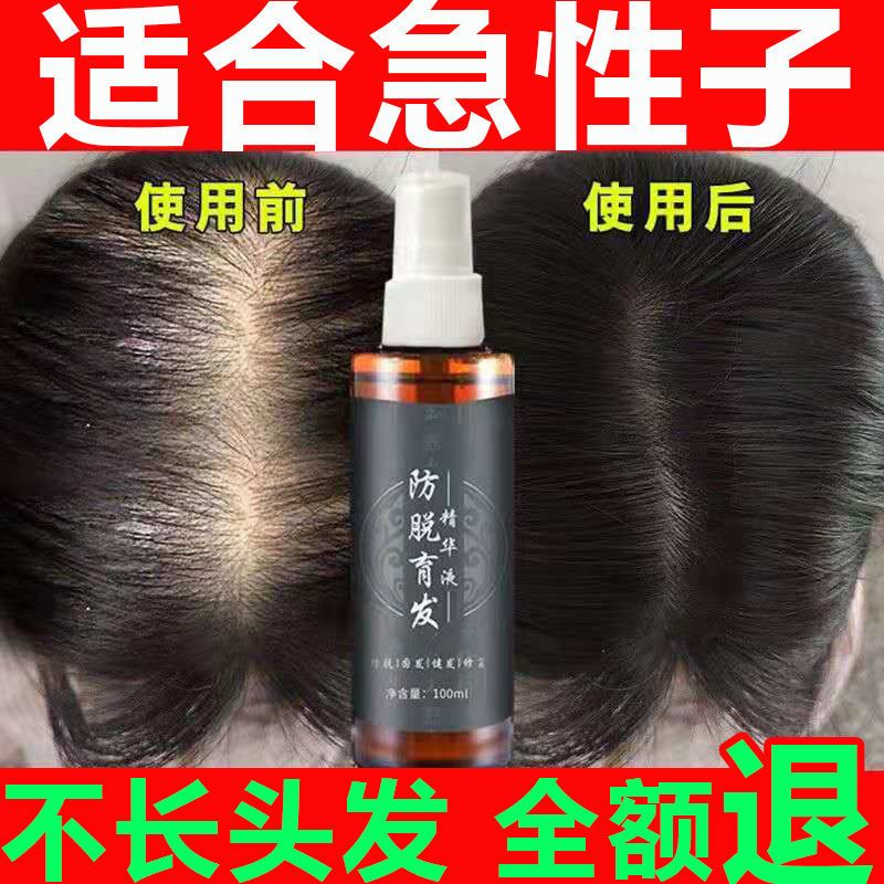 [生新发]育发生发剂增发密发育发液秃顶增长液快速变长头发 单瓶体验装[防脱加生发2000根] 当天生新发 不生发