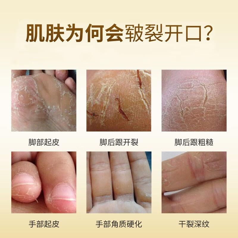 sakose进口马油手足防裂膏3瓶装共150g手脚后跟干裂皲裂保湿补水护手霜高清大图