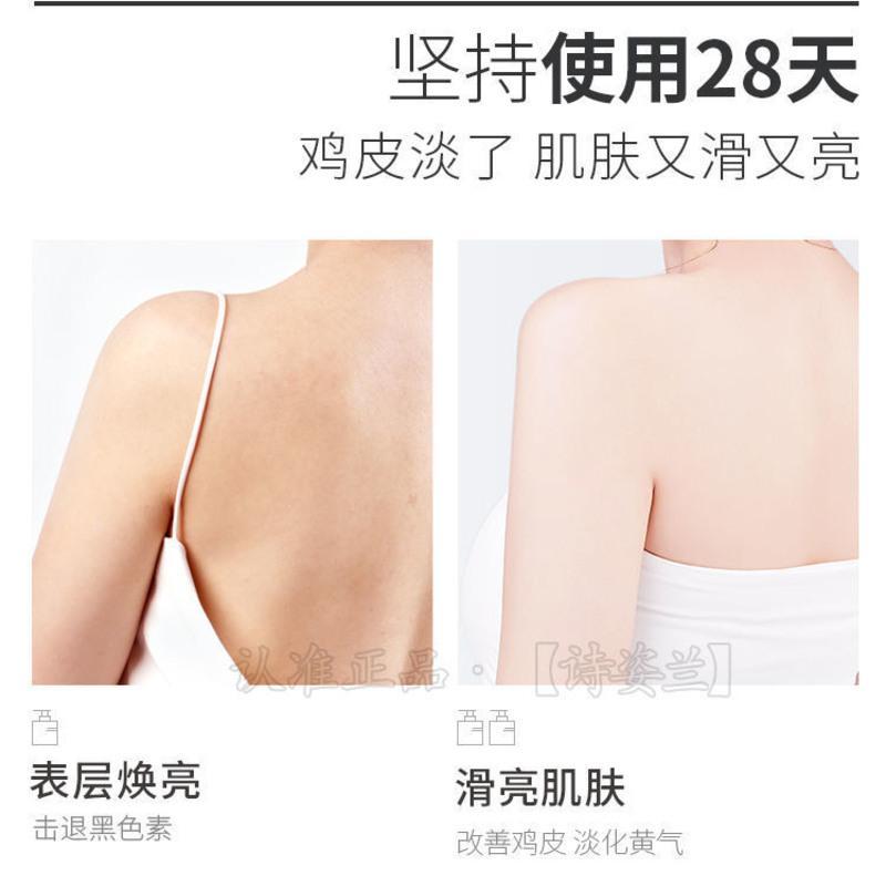 去鸡皮身体乳推荐有用吗的简单介绍