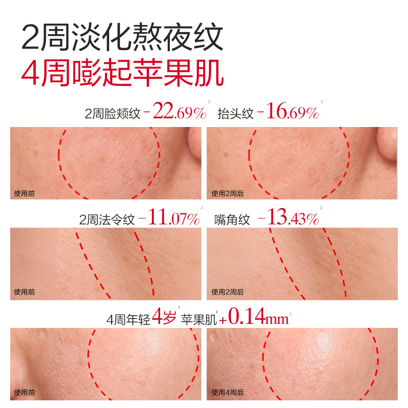 丸美二代多重胜肽小红笔嘭弹霜50g 敏肌紧致淡纹抗皱[重磅升级]+赠品(丸美多重胜肽紧致淡纹嘭弹霜(滋润版)25g*2)高清大图