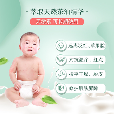 松达婴儿山茶油面霜宝宝润肤保湿滋润舒缓滋养改善干燥苹果脸68g