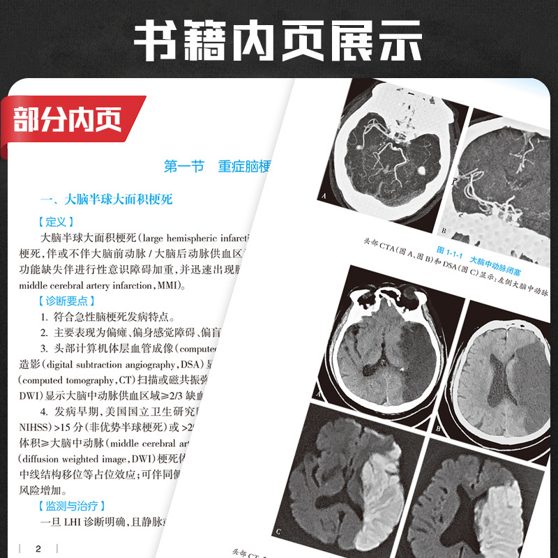 [正版] 神经重症专科医师培训教程 宿英英 神经病学神经内科外科学危重症诊断神经科ICU重症医学脑源性多器官系统功能损