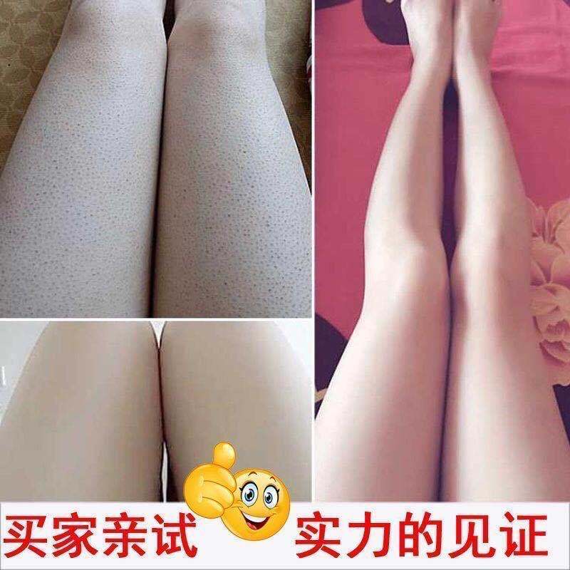 [永久去鸡皮]李佳琦推荐乳木果身体磨砂膏去角质去疙瘩嫩白全身 一瓶送刮板[亏本抢188瓶]