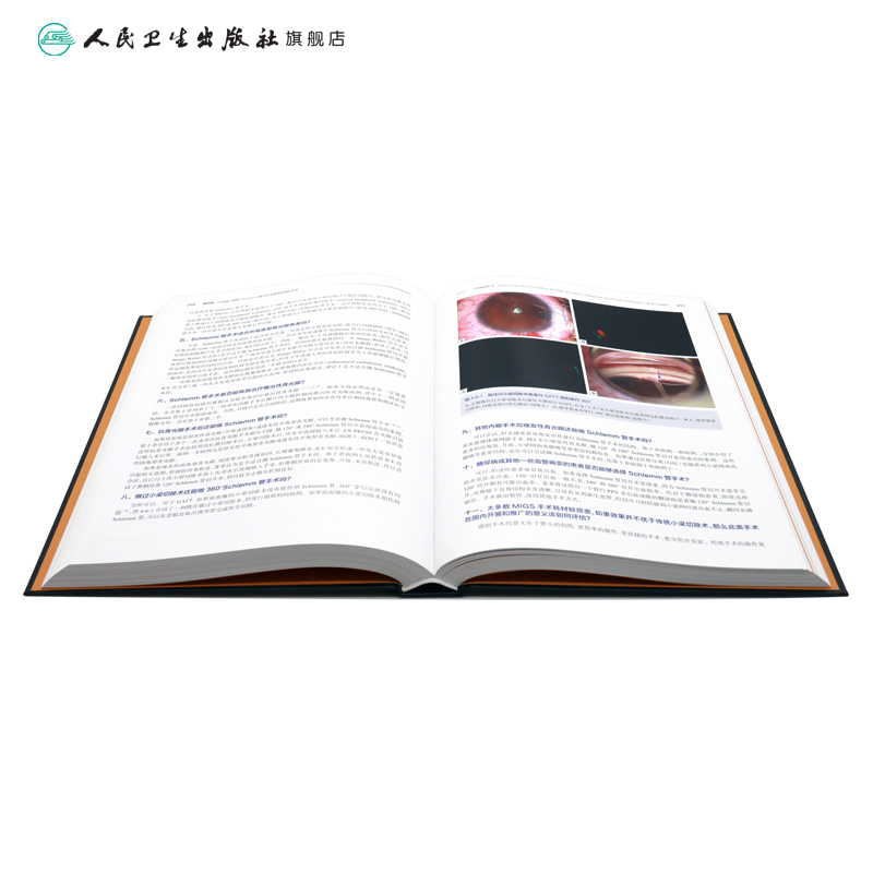 [醉染正版]图解青光眼微创手术操作与技巧 张秀兰视力眼睛恢复训练手术手册白内障眼视光实用临床小儿图谱医生儿童人民卫生出版高清大图