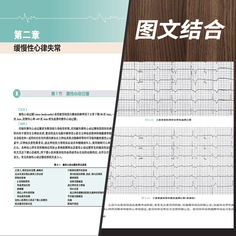 [正版]实用心律失常学 第二2版 内科学心律失常学心血管类书籍 张澍主编 搭心血管内科学高级教程心血管内科医生成长手册高清大图