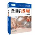 图解拔罐一本通