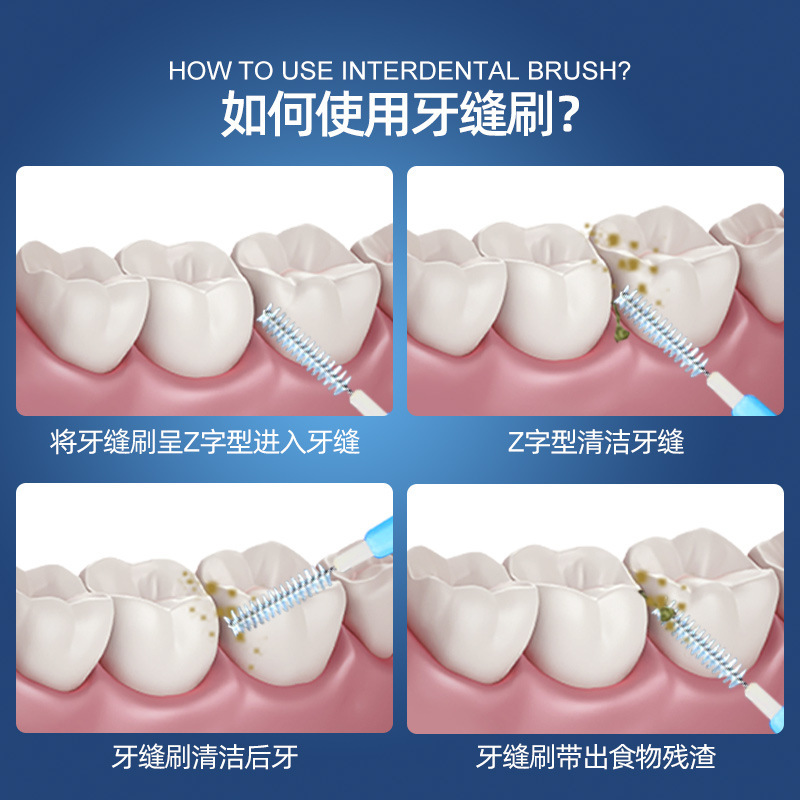 小鹿妈妈 I型牙缝刷超细前排牙间刷ssss 10支装[单支独立]高清大图