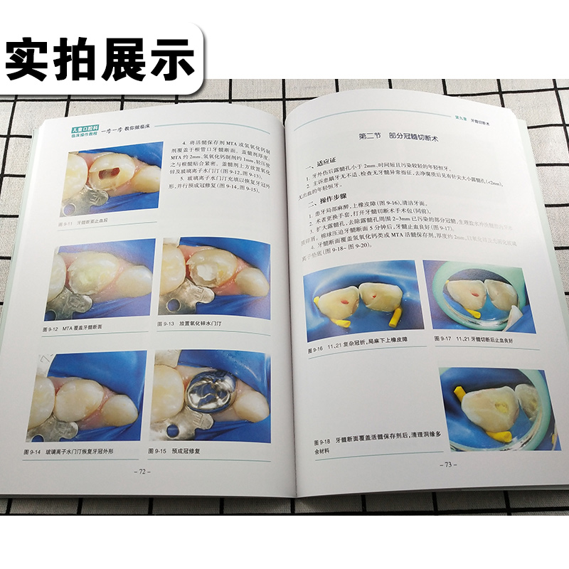 [正版] 儿童口腔科临床操作教程 一步一步教你做临床 彩图版 主编秦满 口腔疾病临床案例诊治教程 人民卫生出版社978高清大图