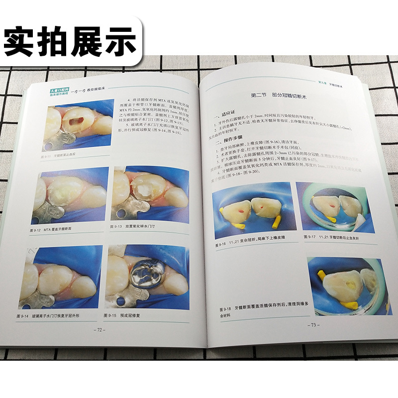 [正版] 儿童口腔科临床操作教程 一步一步教你做临床 彩图版 主编秦满 口腔疾病临床案例诊治教程 人民卫生出版社978