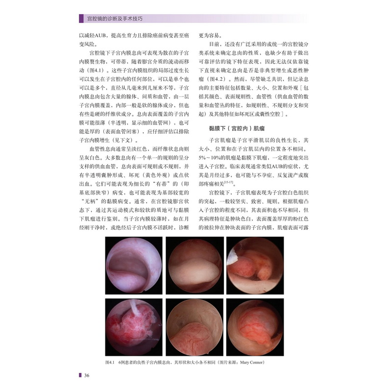 醉染图书宫腔镜的诊断及手术技巧9787571421670高清大图