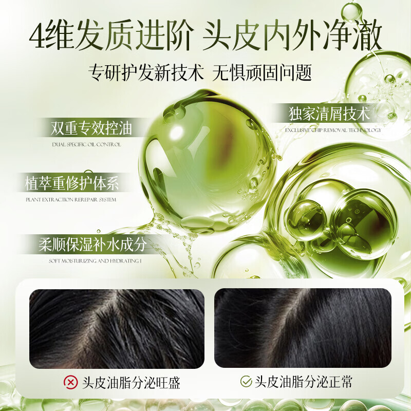维特丝负离子电吹风速干护发静音大功率造型美发神器维特丝 植研多维去屑洗发水500g(蓝)高清大图