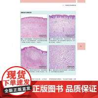[新书]图解富血小板血浆(PRP)微针再生美容实用指南(德)伯纳德·C科尔斯特附加内容二维码 9787559140579