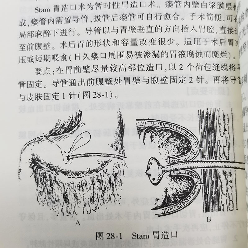 [正版]普通外科疾病诊疗指南(第3版)三版 陈孝平 易继林编 临床医师诊疗丛书 综合症诊疗宝典 临床医学参考 外科学
