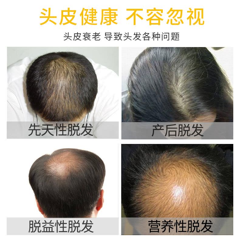 [优先发货]老姜王防脱发生发洗发水生姜汁增发密发育发膏固 重度防脱生发套餐400ml*3+20ml*3 其他/other图片