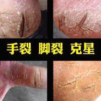马油膏干裂手足防裂膏手脚防脚裂膏脚后跟开裂列咧龟手裂膏春天