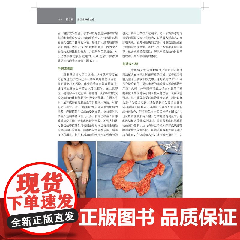 淋巴水肿外科原则与手术技巧 上海科技出版社多国权威专家诊治经验研究指南参考治疗方法理念领域手术技巧高清大图