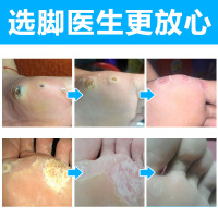 [顽固断除型]脚医生正品祛尤卫士膏液套装脚底上肉刺猴子刺猴寻常尤疣瘊净鸡眼去疣灵足部老茧脚垫胼胝止尤净丝状疣止疣净