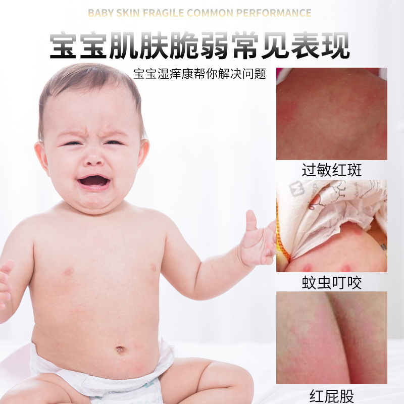 宝宝湿痒康婴儿童湿疹霜皮肤止痒红屁屁奶藓专用蚊虫叮咬消保护剂