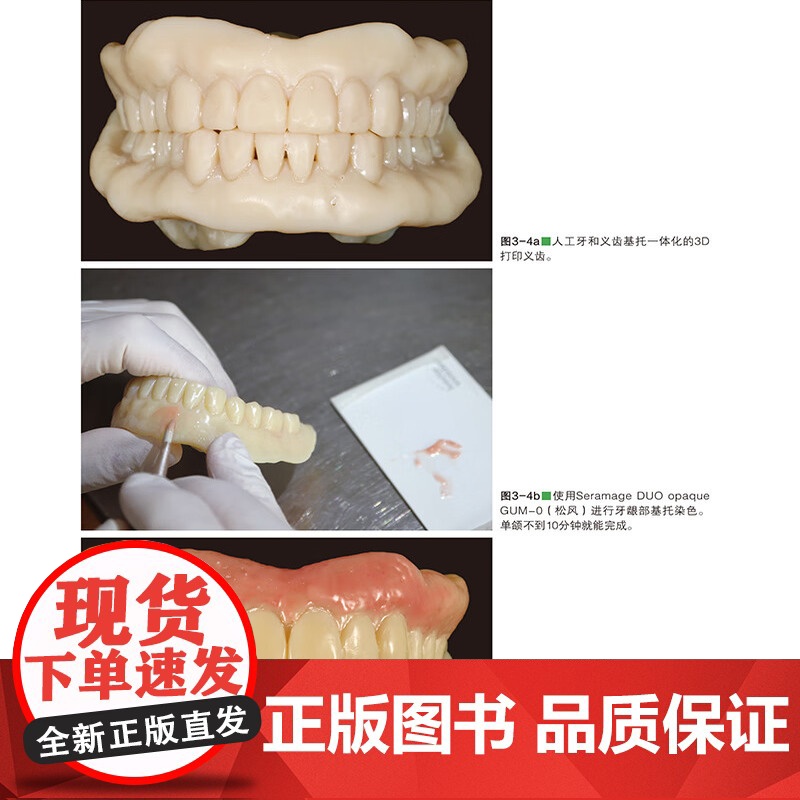 [出版社]数字化全口吸附性义齿新时代 山崎史晃 著 扫描仪和软件差异分析义齿制作方法口腔美容种植 辽宁科学技术出版社高清大图