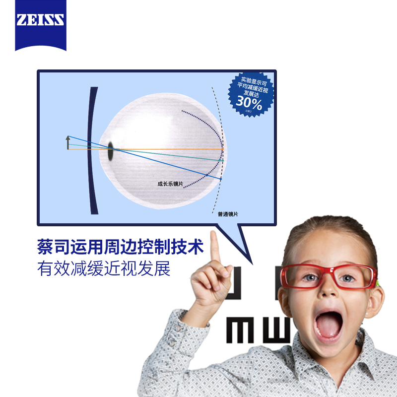 zeiss德国蔡司成长乐镜片儿童防控近视钻立方铂金膜1.5/1.6/1.67学生青少年离焦眼镜原厂