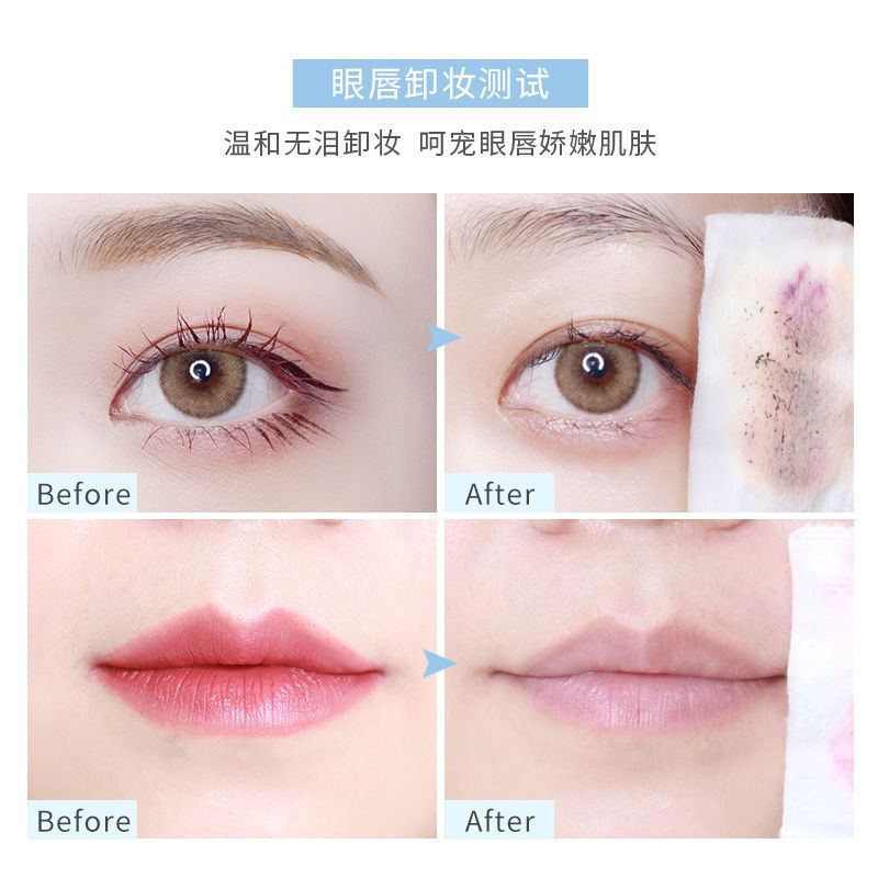 稚优泉酵素卸妆水脸部温和清洁眼部眼唇卸妆液学生按压瓶女 眼唇卸妆液