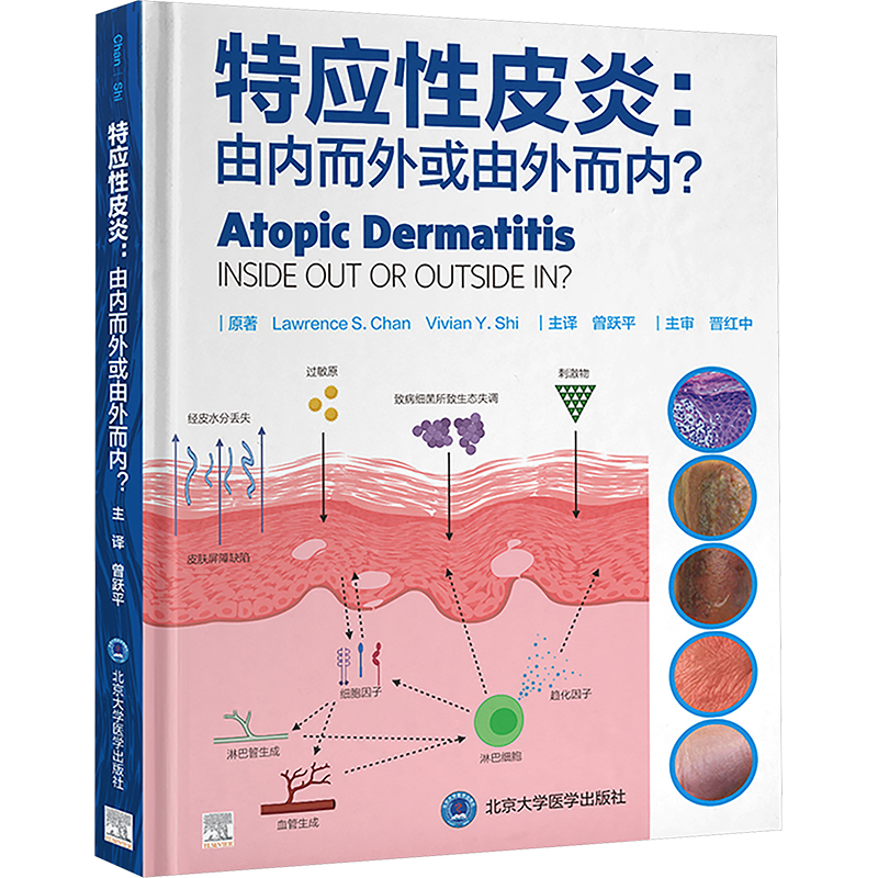 [M]特应性皮炎 由内而外或由外而内?-9787565930300高清大图
